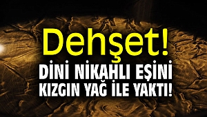 Dehşet! Dini nikahlı eşini kızgın yağ ile yaktı!