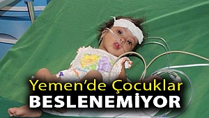 Yemen’de çocuklar beslenemiyor