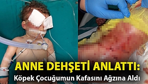 Anne dehşeti anlattı: Köpek çocuğumun kafasını ağzına aldı
