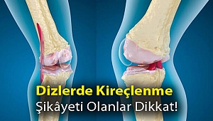 Dizlerde kireçlenme şikâyeti olanlar dikkat!