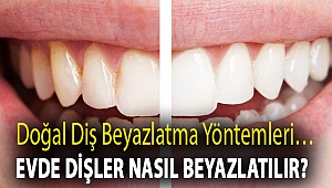 Doğal diş beyazlatma yöntemleri… Evde dişler nasıl beyazlatılır?
