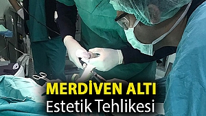 Merdiven altı estetik tehlikesi