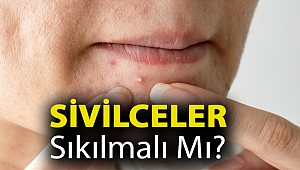 Sivilceler sıkılmalı mı?