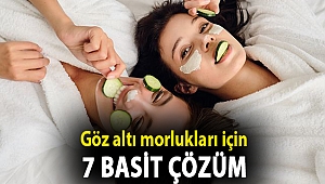 Göz altı morlukları için 7 basit çözüm