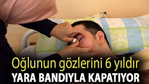 Yatalak oğlunun gözlerini 6 yıldır yara bandıyla kapatıyor