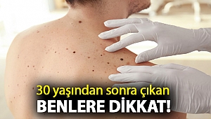 30 yaşından sonra çıkan benlere dikkat!