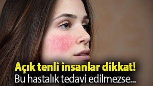 Gül hastalığı belirtileri nelerdir? Gül hastalığı tedavi edilebilir mi?
