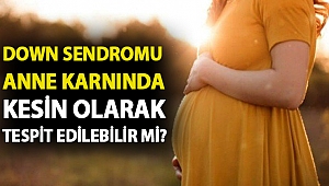 Down sendromu anne karnında kesin olarak tespit edilebilir mi?