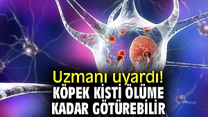 Uzmanı uyardı!