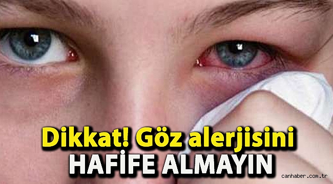 Dikkat! Göz alerjisini hafife almayın