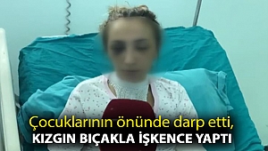 Çocuklarının önünde darp etti, kızgın bıçakla işkence yaptı