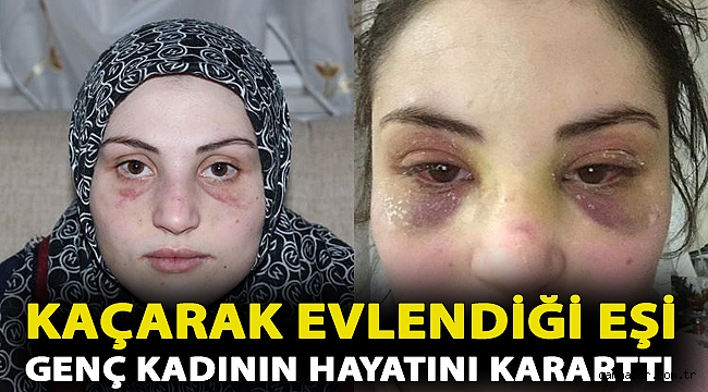 Kaçarak evlendiği eşinin tekme, tokat ve demir borulu şiddetine maruz kaldı!