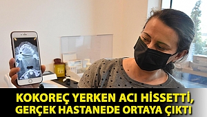 Kokoreç yerken acı hissetti, gerçek hastanede ortaya çıktı