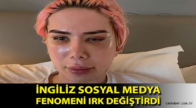 Irk değiştirme ameliyatı olan İngiliz sosyal medya fenomeni: Kendimi Koreli olarak tanımlıyorum