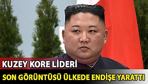 Kuzey Kore lideri Kim'in kilo kaybının halkta endişelere neden olduğu iddia edildi