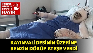 Kayınvalidesinin üzerine benzin döküp ateşe verdi