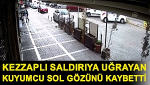 İş yerinin önünde kezzaplı saldırıya uğrayan kuyumcu sol gözünü kaybetti