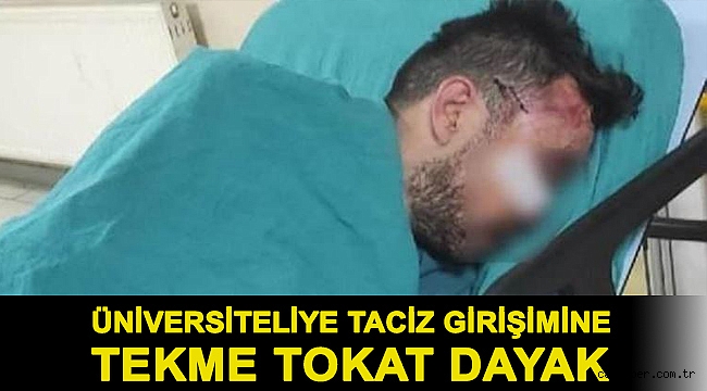 Üniversiteliye taciz girişimine tekme tokat dayak
