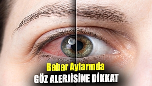 Bahar aylarında göz alerjisine dikkat
